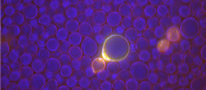 cell structures of old yeast