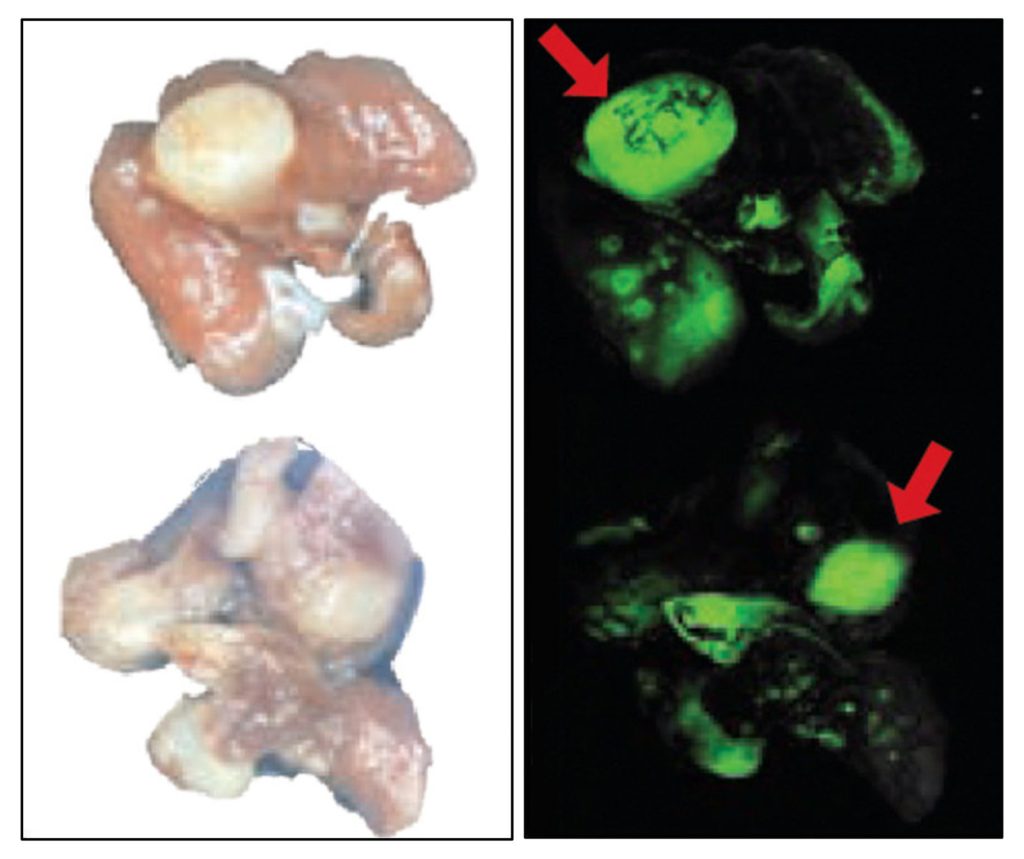 Tumors induced in aged mouse lungs show larger, more aggressive, tumor growth.